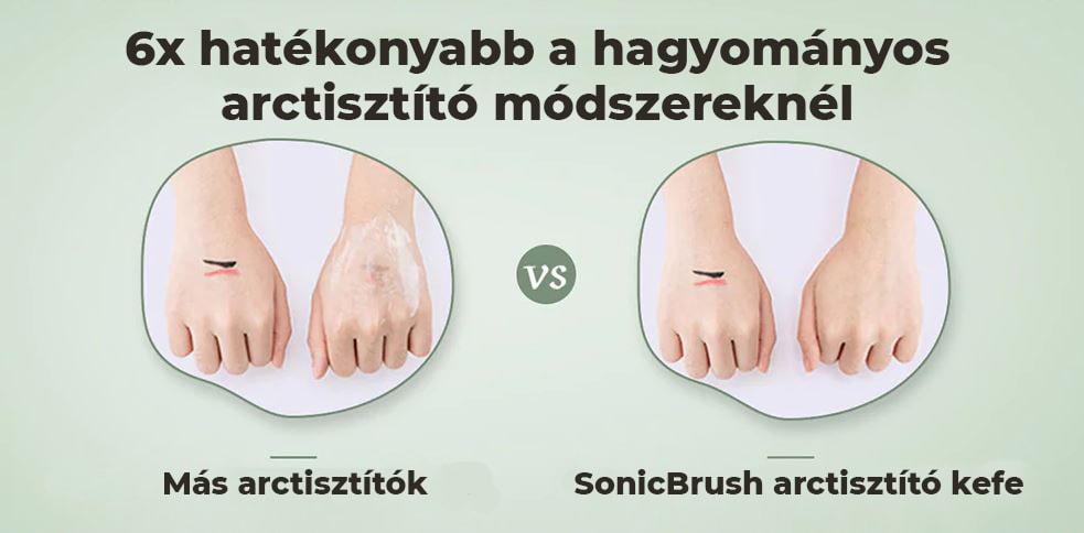 SonicBrush Spazzola per la Pulizia del Viso